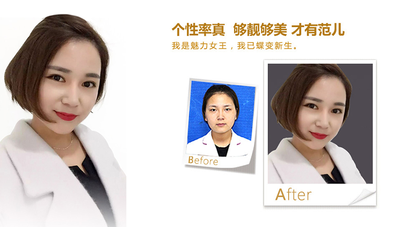 秦皇岛美鼻、V脸